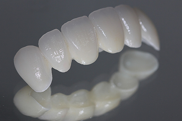 The image shows a set of dental veneers with a white shade, displayed against a dark background.