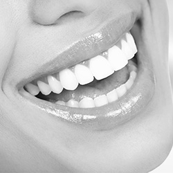The image shows a close-up of a person s smiling face with teeth visible, giving an impression of happiness or contentment.