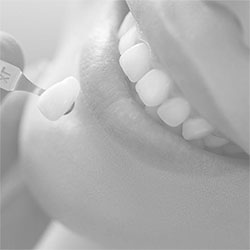 The image shows a close-up of a person s smiling face with teeth being worked on by dental instruments, likely during a dental appointment or procedure.