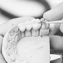 The image shows a person working on a dental mold with a small drill, focusing on details within a mouthpiece.