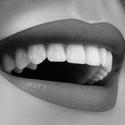 An image of a person s open mouth displaying white teeth against a blurred background.