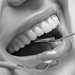The image shows a person with an open mouth, displaying a set of teeth, while holding dental tools, likely during a dental procedure.