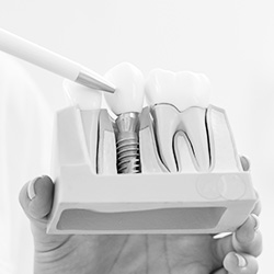 The image shows a person s hand holding a dental tool near an open drawer containing multiple toothbrushes, with a focus on oral hygiene tools.