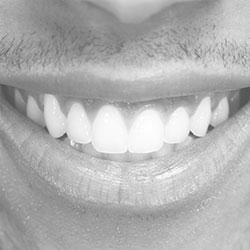 The image shows a close-up view of a person s smiling face with teeth, capturing an expression of joy or happiness.