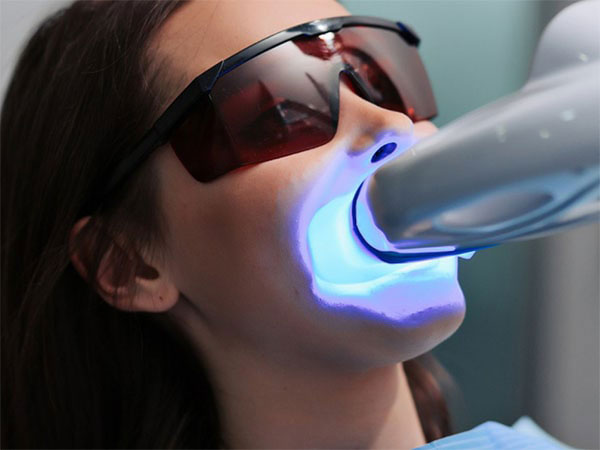 A woman wearing protective eyewear and a blue light apparatus on her face, likely for dental care purposes, with a focus on her open mouth.