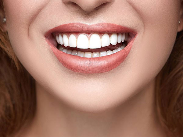 The image shows a close-up of a person s face with a bright smile and well-maintained teeth, against a blurred background.