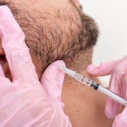 A man receiving a facial hair removal treatment with a syringe being injected into his skin by a person wearing gloves.