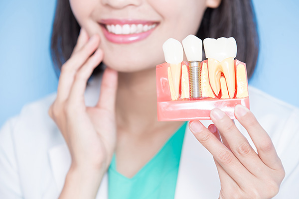 The image shows a smiling woman holding a dental model with a toothpaste tube and a toothbrush placed on it, indicating dental hygiene practices.