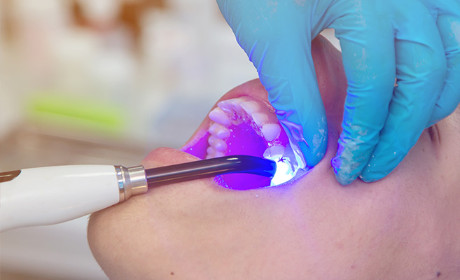 A dental hygienist using an ultrasonic scaler on a patient s teeth.