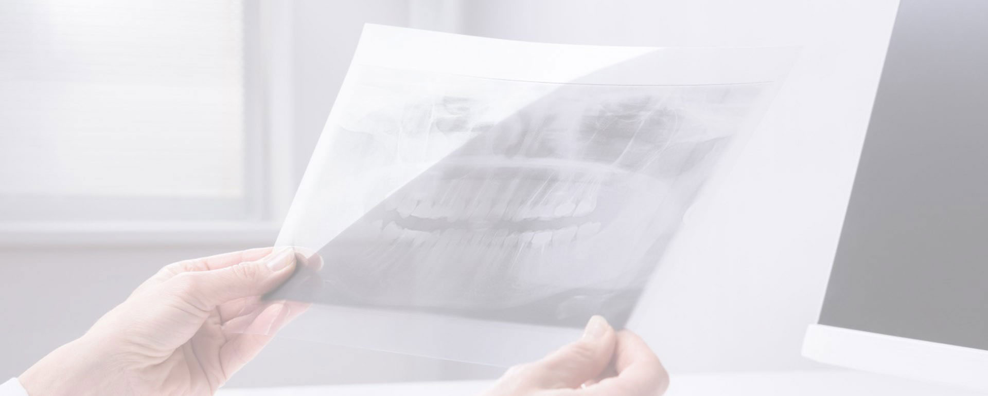 A person holding a large X-ray over a desk, with another smaller X-ray being held by their other hand, both appearing to be medical images.