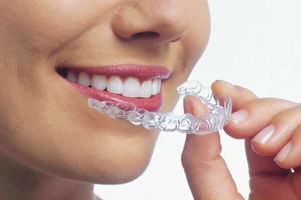 The image shows a person wearing clear aligners over their teeth, which are being held by a hand visible in the foreground.