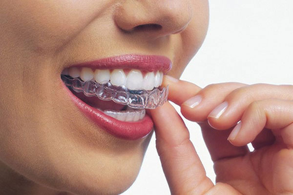 The image shows a person with a clear orthodontic appliance, possibly an aligner tray, adjusting their teeth while smiling broadly.