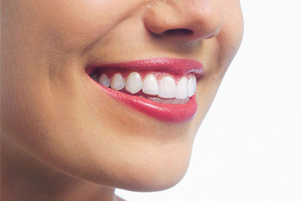 The image shows a smiling woman with well-defined facial features, including her teeth, lips, nose, and eyes, against a white background.