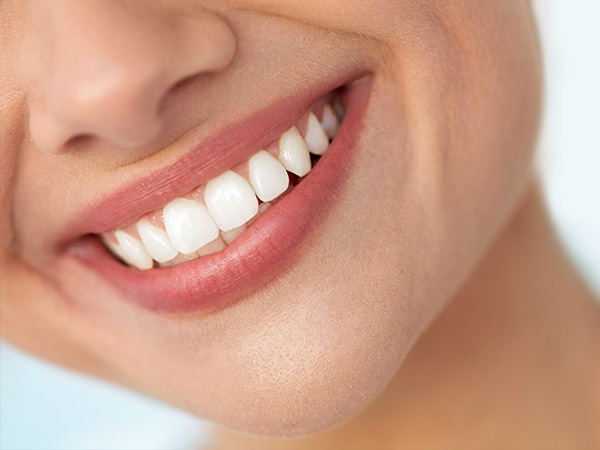 The image shows a close-up of a smiling person with straight teeth, against a plain background.