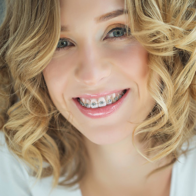 A woman with braces smiling at the camera.